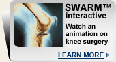 Animation on knee surgery