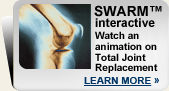 Animated Total Joint Replacement