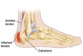 illustration of the foot and heel